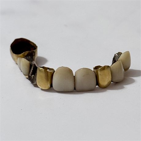 Early 20th Century Gold and Porcelain Dental Bridge